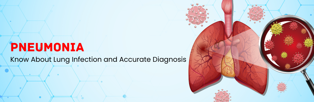 Pneumonia: All You Want to Know About Lung Infection and Accurate Diagnosis